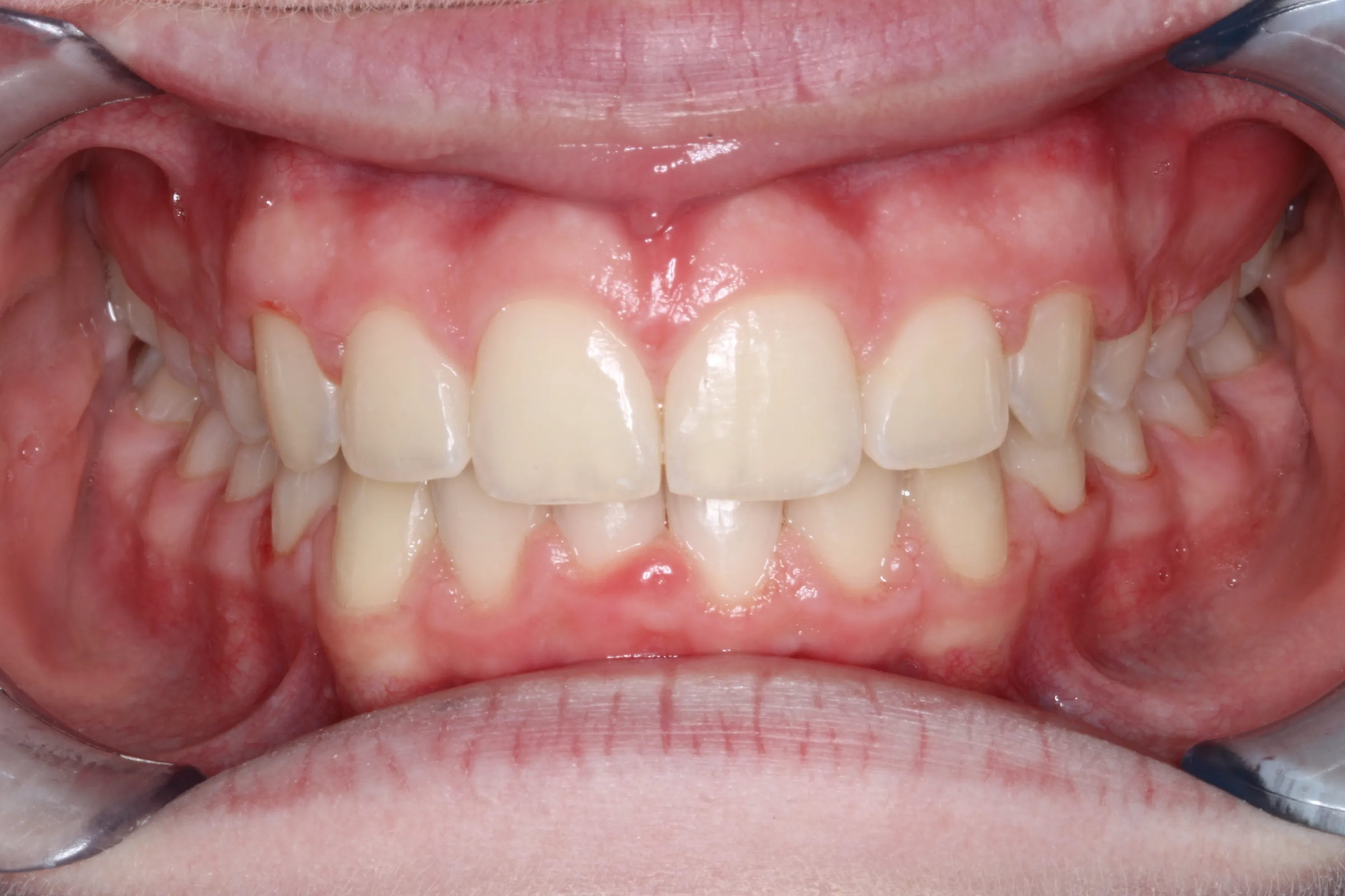 smile-gallery gallery